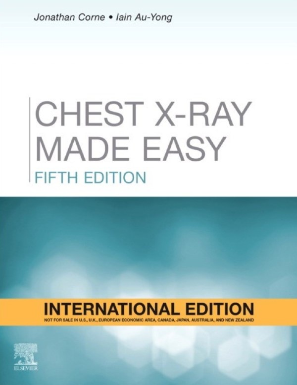 Книга Chest X-Ray Made Easy 5th Edition (9780702082351)